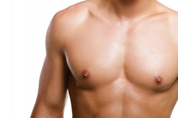 Gynecomastia